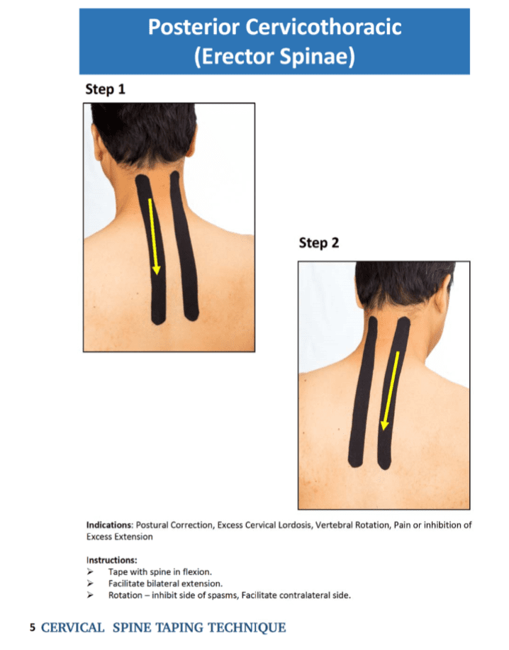 Cervical Spine Taping 2