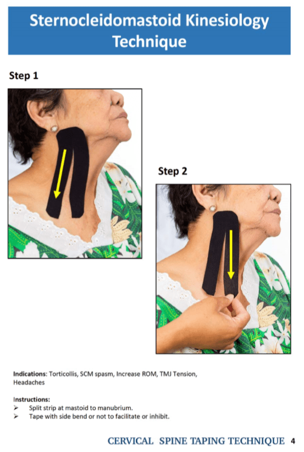 Cervical Spine Taping
